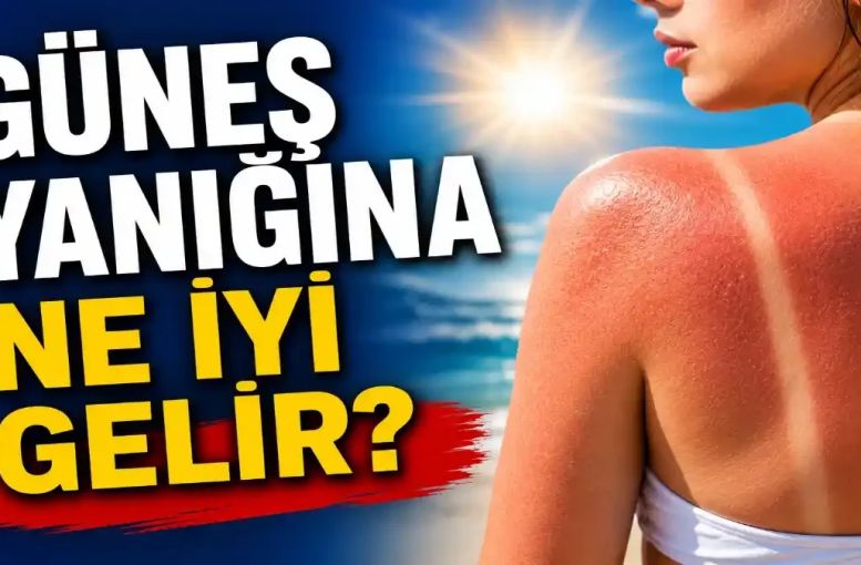 Güneş Yanığına Ne İyi Gelir? Yanlış Müdahaleler Cildi Daha Fazla Zorlayabiliyor