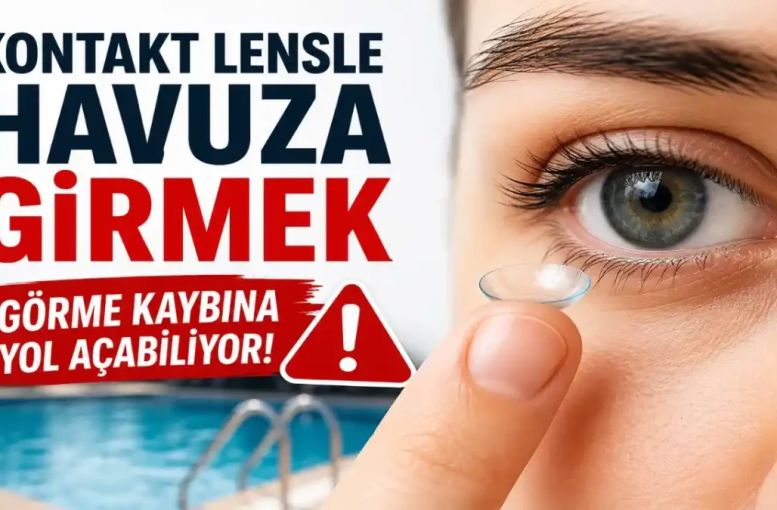 Lensle Denize Veya Havuza Girilir Mi, Acanthamoeba Keratiti Nedir? Göz Sağlığını Tehdit Eden Risk