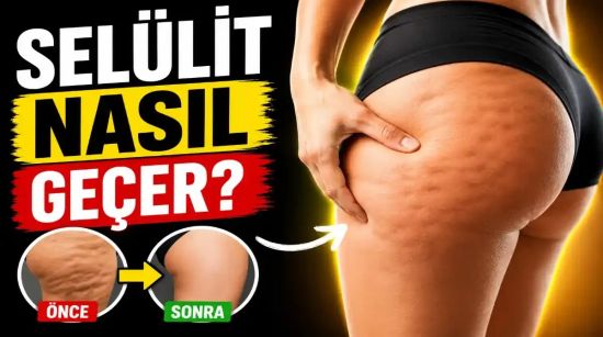 Selülit Nasıl Geçer? Bilimsel Olarak En Etkili Yöntemler