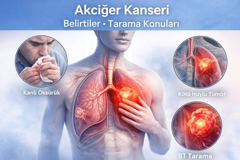 Akciğer Kanseri Belirtileri: Erken Dönem Bulgular ve Tarama Verileri