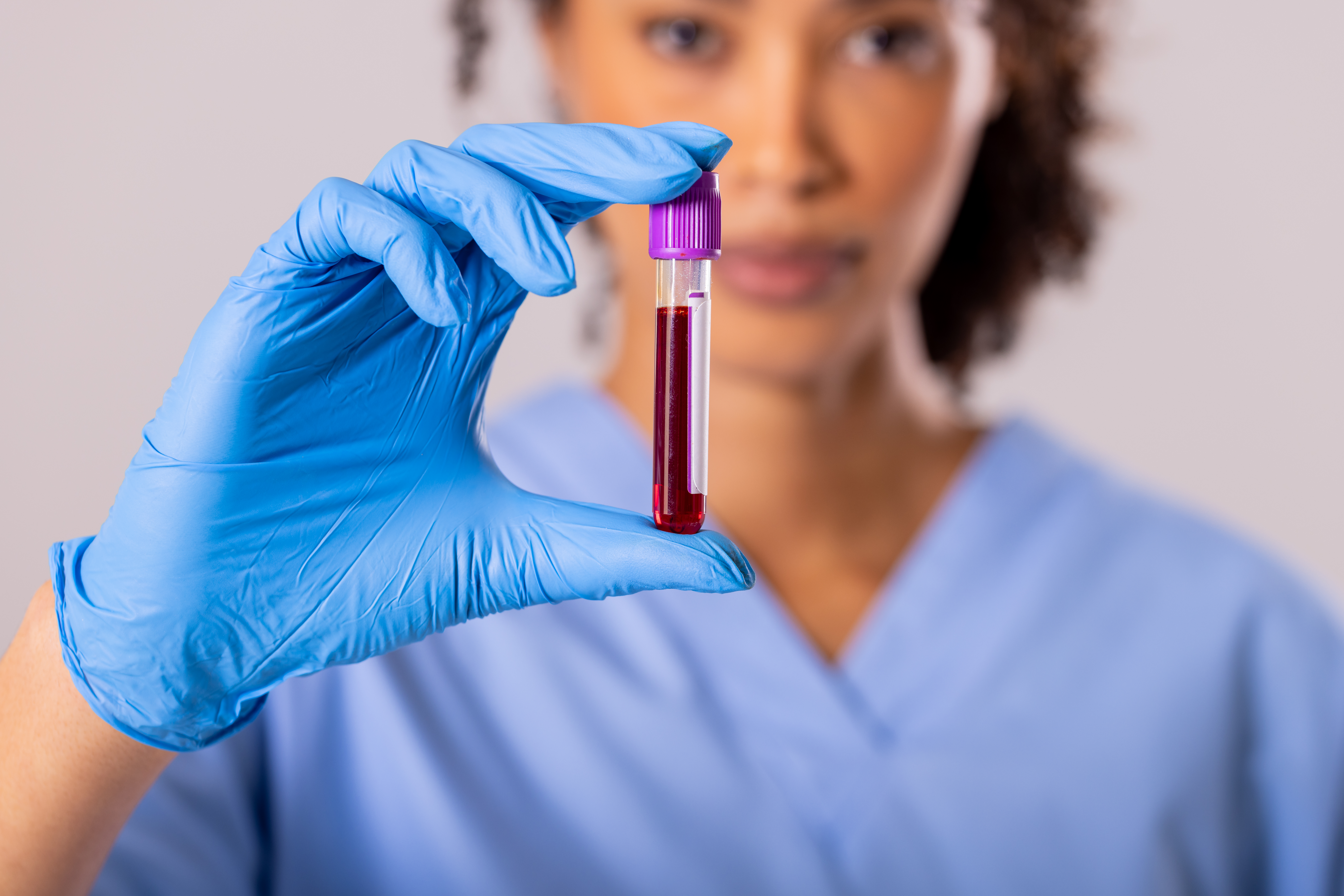 Albumin Nedir? Albumin Neden Yükselir?