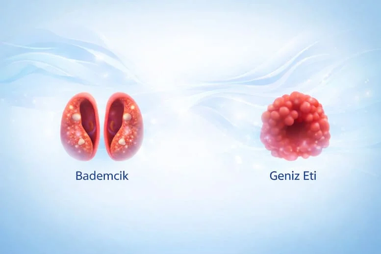 Bademcik İltihabı ve Geniz Eti Nedir? Belirtiler, Nedenler ve Tedavi