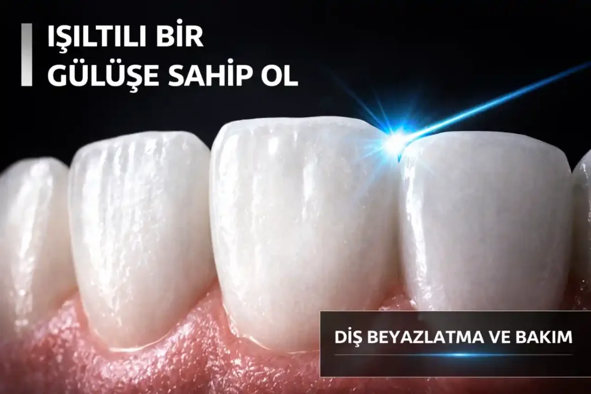 Diş Beyazlatma ve Estetik Aydınlık: Lazerden Ev Tipi Yöntemlere