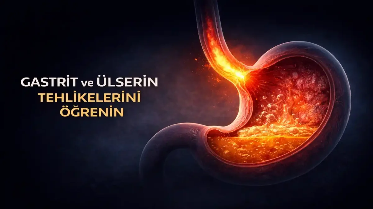 Gastrit, Ülser ve Helicobacter pylori Rehberi: Belirtiler, Nedenler, Diyet ve Reflü Farkı
