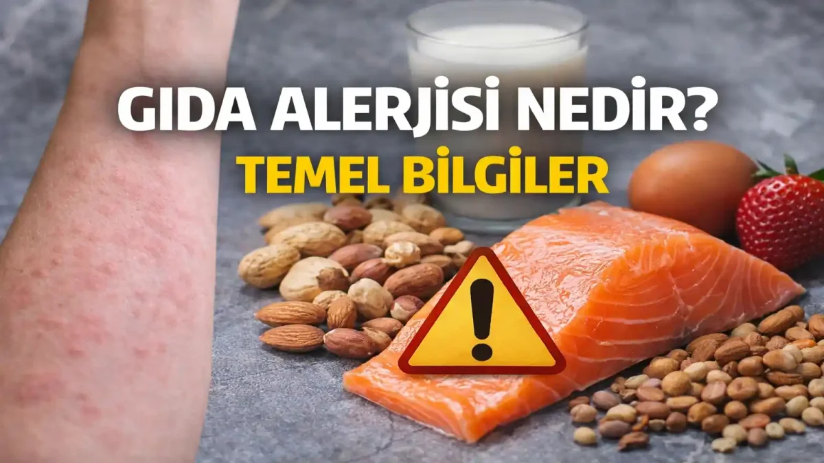 Gıda Alerjisi Neden Olur? Alerji Ve İntolerans Farkı