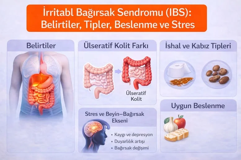 İrritabl Bağırsak Sendromu (IBS): Belirtiler, Tipler, Beslenme ve Stres
