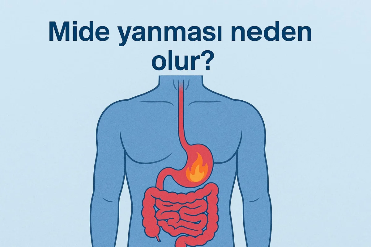 Mide Yanmasının Nedenleri: Asit Yükselmesi, Reflü ve Diğer Tetikleyiciler