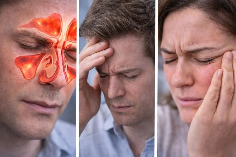 Sinüzit Nedir? Baş ve Yüz Ağrısının En Sık Nedenleri