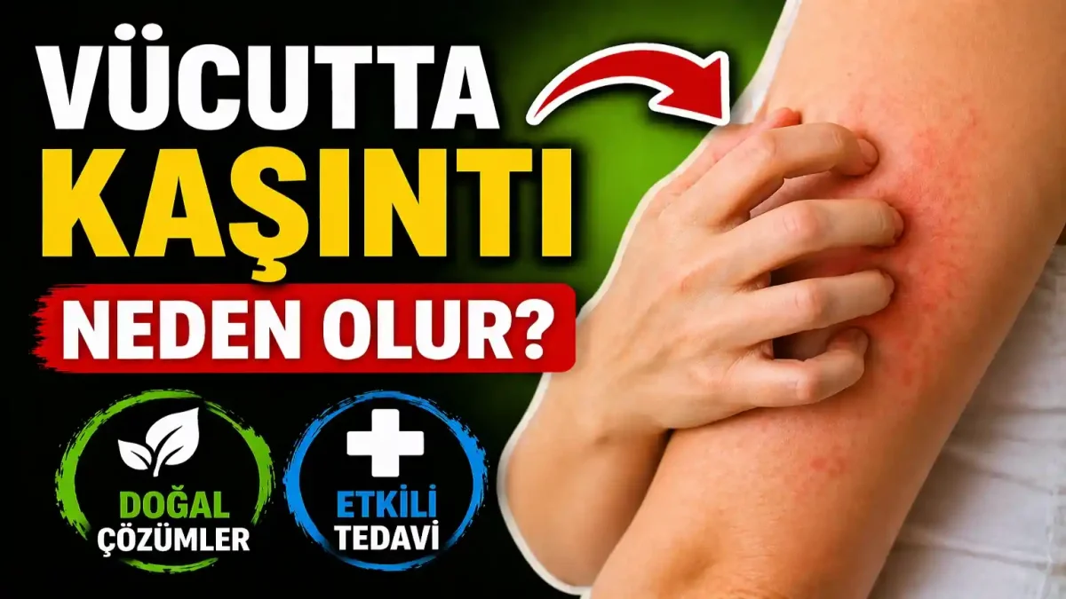 Vücutta Kaşıntı Neden Olur? Belirtiler, Tedavi Ve Doğal Çözümler